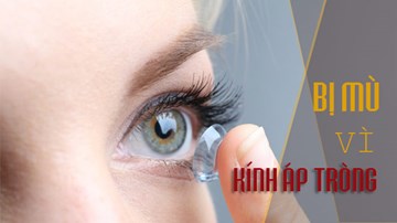Đừng để bị mù vì lỗi nhỏ nhặt này khi dùng kính áp tròng