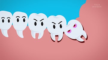 Sự tích răng khôn và vì sao chúng hành hạ con người đến vậy?