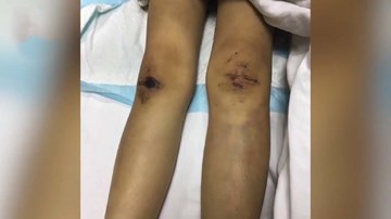 Bé 6 tuổi bị mẹ kế bạo hành hôn mê, ra tòa không có người thân