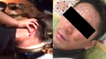 Bị ấn đầu vào nổi lẩu mua vui, nhân viên chờ 3 năm mới kiện sếp