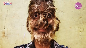 Ước mơ giản dị khó thành hiện thức của cậu bé 'ma sói'