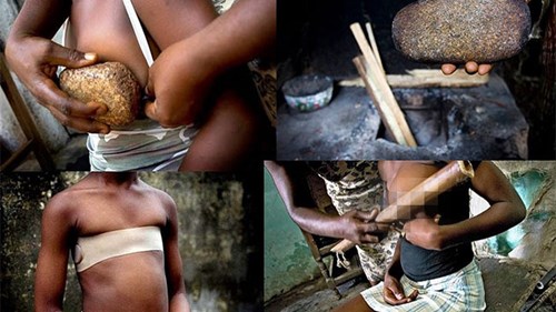 Rùng mình trước hủ tục 'là ngực' để tránh bị quấy rối tình dục