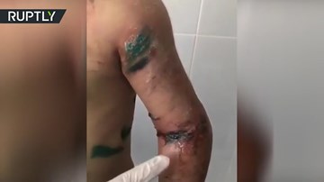 Bác tra tấn cháu ruột như thời Trung cổ gây chấn động dư luận Nga