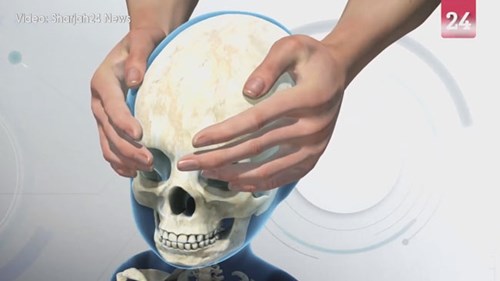 Nhằm khẳng định địa vị, người Trung Quốc xưa kéo dài hộp sọ như thế nào?