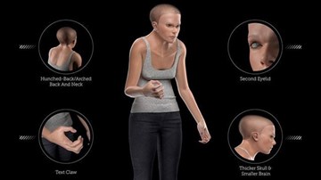 Cảnh báo con người sẽ 'biến dạng' kỳ dị do điện thoại di động, máy tính