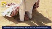 Chôn mình trong cát dưới nắng 50 độ để chữa đột quỵ, nhức xương