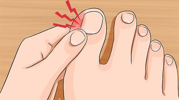 Vì sao va đập nhẹ ở ngón chân lại làm chúng ta đau 'thấu trời'?