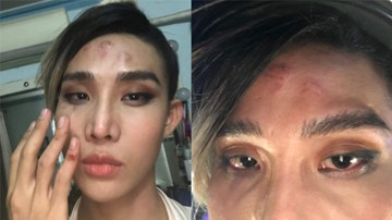 Mid Nguyễn lên tiếng vụ bị tài xế GoViet hành hung