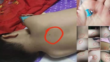 Điều tra 3 giáo viên mầm non nghi dùng kim ghim bảng đâm trẻ