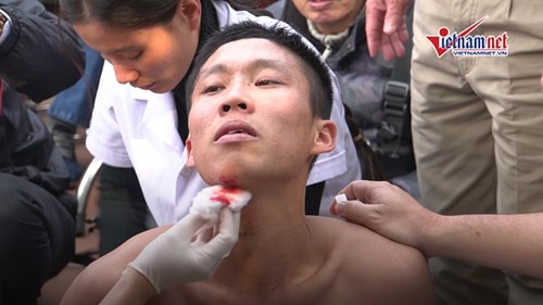 Trai tráng Thủ đô đổ máu tại lễ hội vật cầu son đầu năm