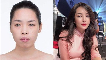 Nữ chính 'Người ấy là ai' lột xác ngoạn mục sau cắt xương hàm, chỉnh hô