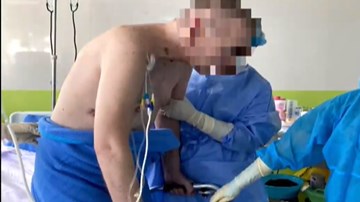 Bệnh nhân số 91 tự ngồi dậy và ăn uống theo nhu cầu