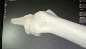 Công nghệ mới này có thể hỗ trợ từ xa cho hàng nghìn bệnh nhân