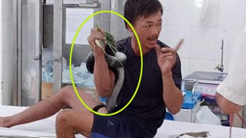 Bị cắn, bệnh nhân ôm luôn rắn hổ mang chúa dài 3m, nặng 4,5kg đi cấp cứu