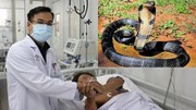 Bị rắn độc cắn: Xử trí không đúng có thể gây tử vong tại chỗ