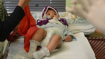 Vì sao quốc gia hiện đại như Singapore vẫn còn hủ tục cắt bỏ âm vật?