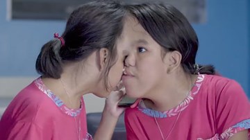 Cặp song sinh dính liền đặc biệt với ước mơ thành ngôi sao trên MXH
