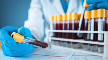 Nhóm máu nào có nguy cơ bị đau tim cao nhất?