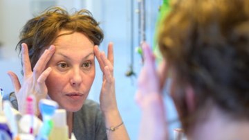 Lông mày rụng bất thường có thể là dấu hiệu cảnh báo bệnh tuyến giáp