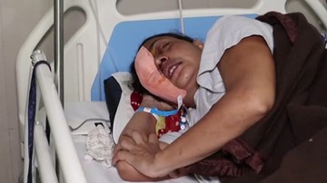 Số ca nhiễm tăng cao, Ấn Độ xếp bệnh 