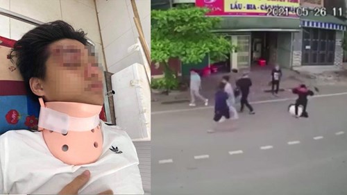 Nam sinh bị 7 thanh niên đánh hội đồng, nằm bất động giữa đường