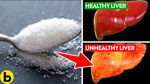 Đường có thể âm thầm huỷ hoại gan như thế nào?