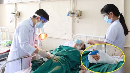 Nối thành công bàn tay người đàn ông ở Bình Dương bị chém đứt lìa