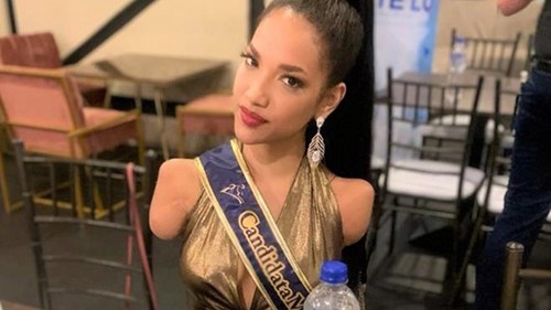 Thí sinh cụt 2 tay, mất 1 chân vào chung kết hoa hậu Ecuador