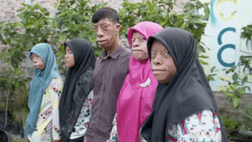 Bí ẩn gia đình có 4 người mang khuôn mặt 'hình cá'