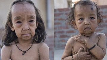 Cuộc sống của những đứa trẻ già hơn nhiều lần so với cha mẹ