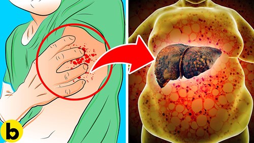 Những bất thường trên da có thể cảnh báo căn bệnh nguy hiểm nào?